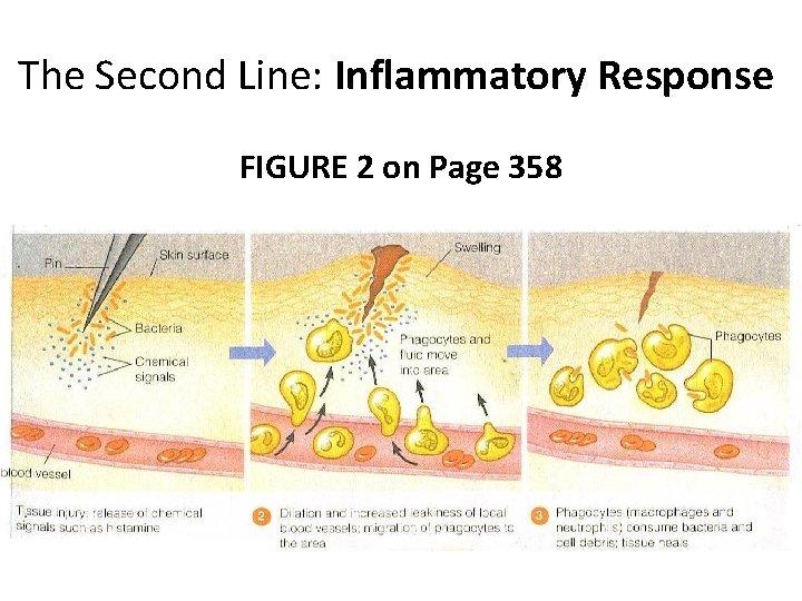 The Second Line: Inflammatory Response FIGURE 2 on Page 358 