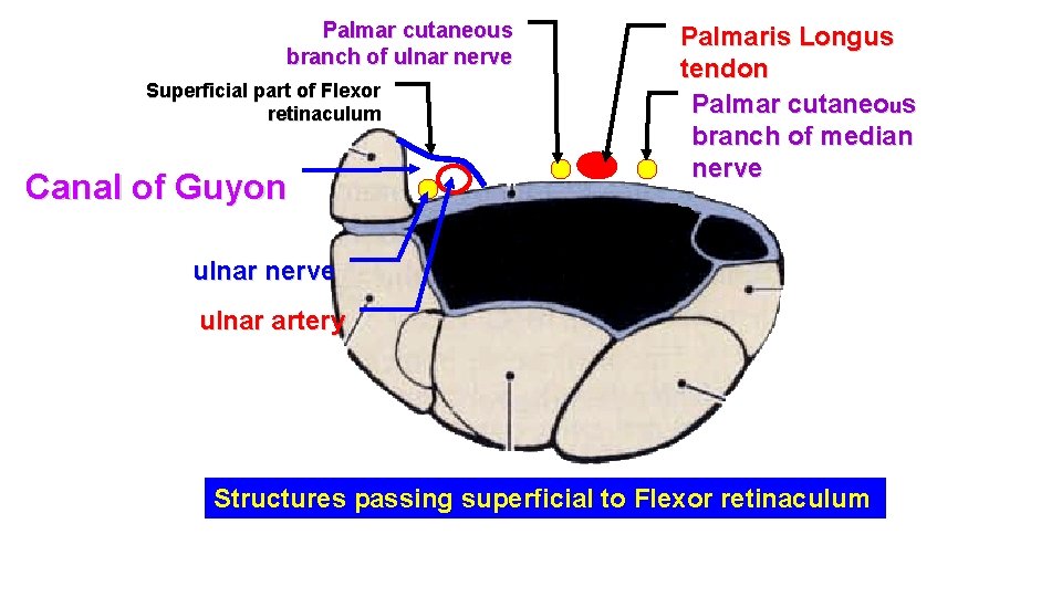 Palmar cutaneous branch of ulnar nerve Superficial part of Flexor retinaculum Canal of Guyon