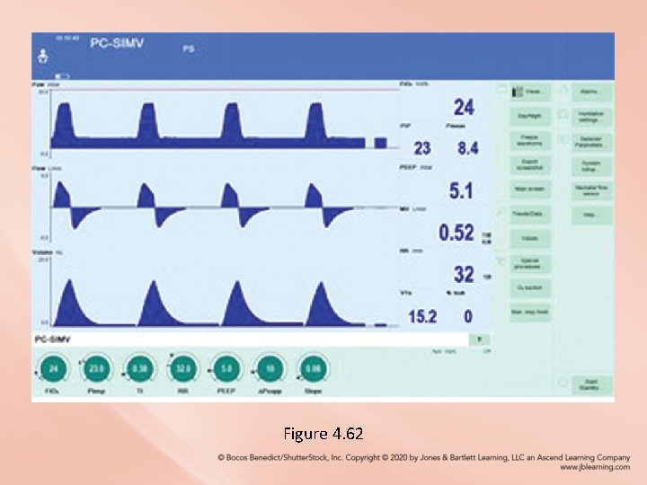 Figure 4. 62 