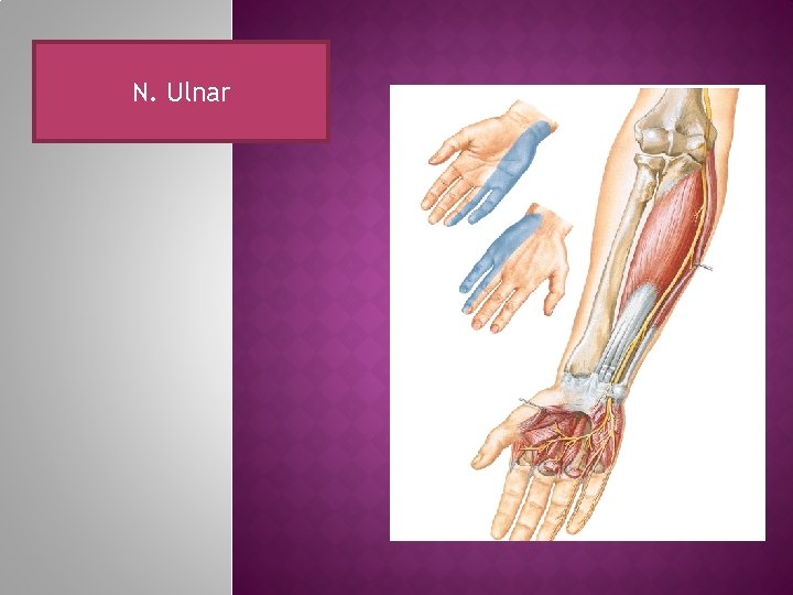 N. Ulnar 
