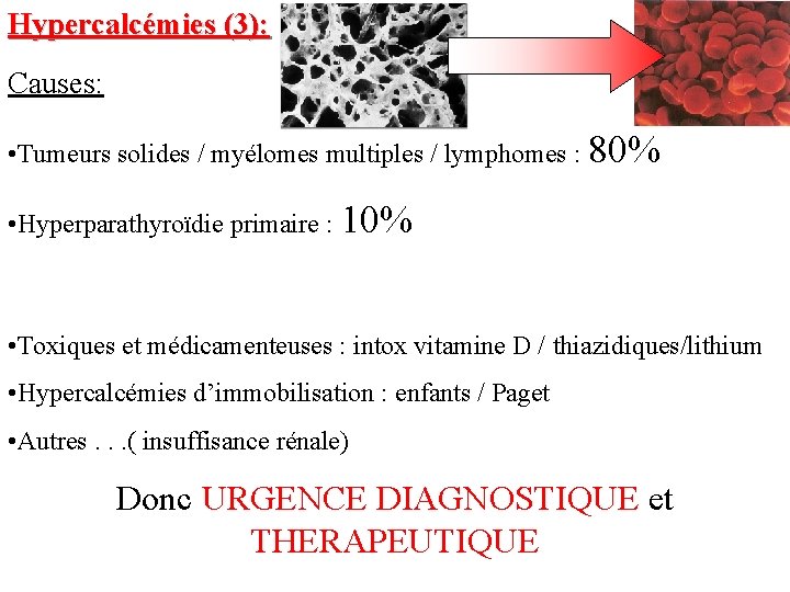 Hypercalcémies (3): Causes: • Tumeurs solides / myélomes multiples / lymphomes : 80% •