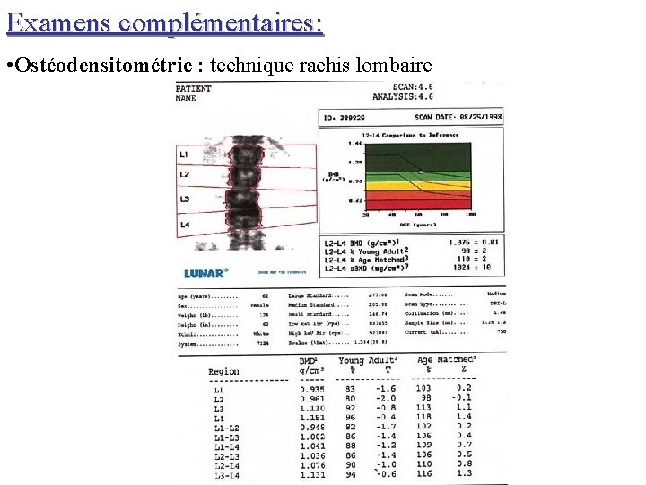 Examens complémentaires: • Ostéodensitométrie : technique rachis lombaire 