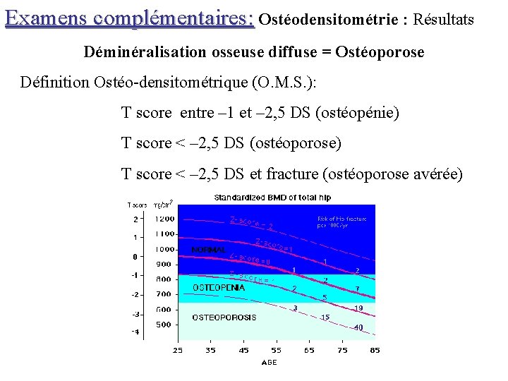 Examens complémentaires: Ostéodensitométrie : Résultats Déminéralisation osseuse diffuse = Ostéoporose Définition Ostéo-densitométrique (O. M.