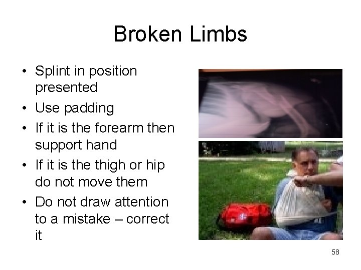 Broken Limbs • Splint in position presented • Use padding • If it is