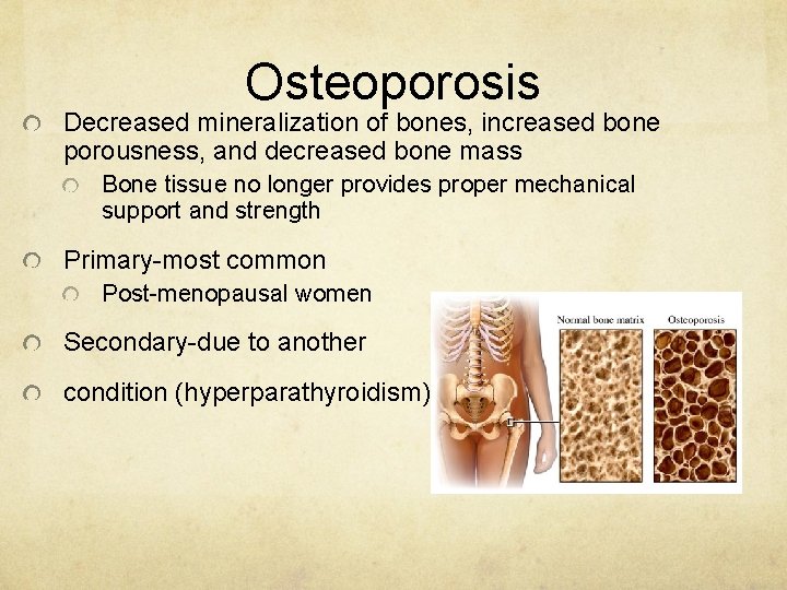 Osteoporosis Decreased mineralization of bones, increased bone porousness, and decreased bone mass Bone tissue