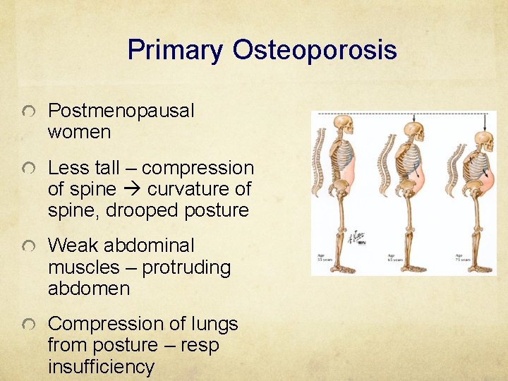 Primary Osteoporosis Postmenopausal women Less tall – compression of spine curvature of spine, drooped