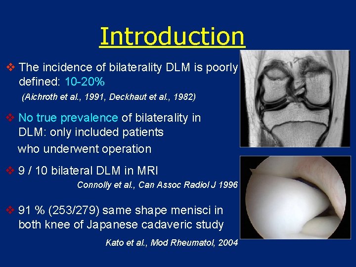 Introduction v The incidence of bilaterality DLM is poorly defined: 10 -20% (Aichroth et