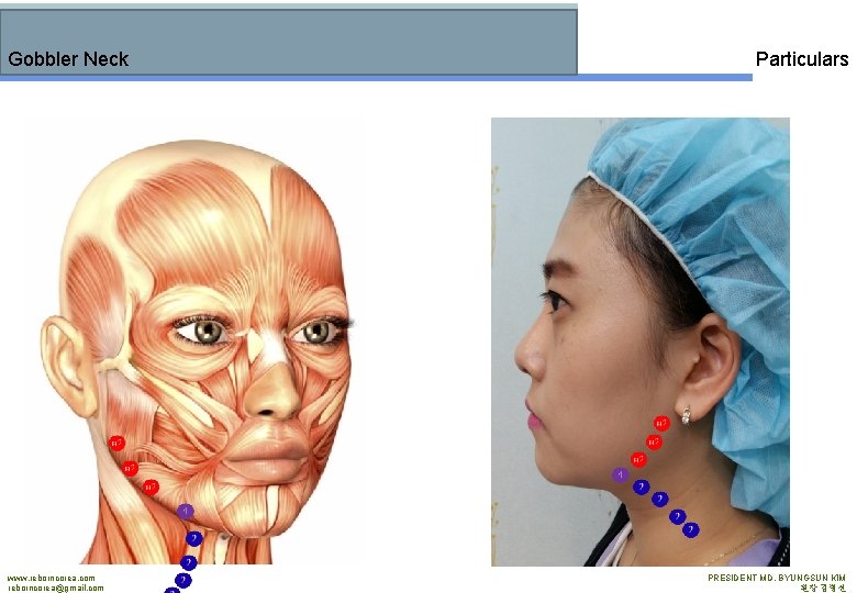 Gobbler Neck www. reborncorea. com reborncorea@gmail. com Particulars PRESIDENT MD. BYUNGSUN KIM 원장 김병선