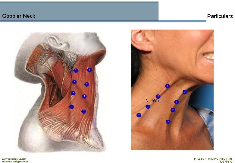 Gobbler Neck Particulars D : 15 mm www. reborncorea. com reborncorea@gmail. com PRESIDENT MD.