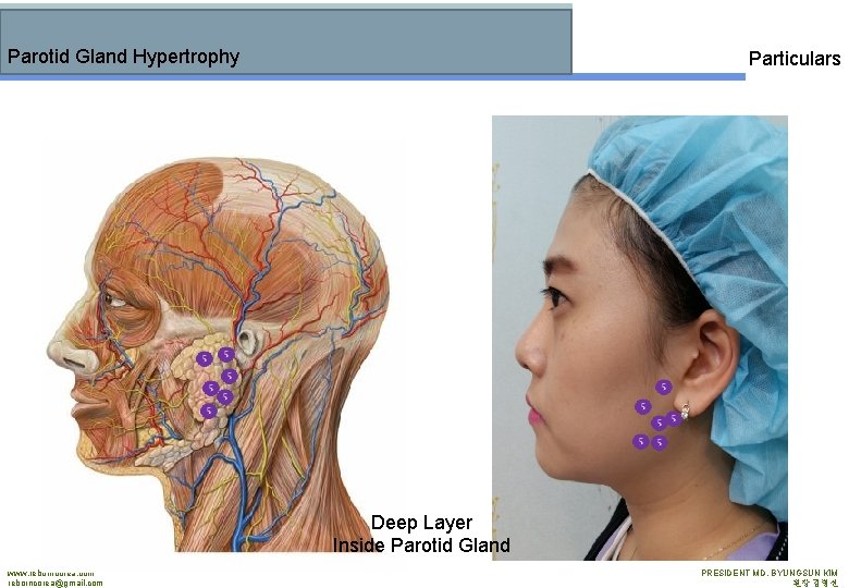 Parotid Gland Hypertrophy Particulars Deep Layer Inside Parotid Gland www. reborncorea. com reborncorea@gmail. com
