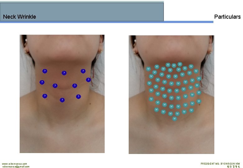 Neck Wrinkle www. reborncorea. com reborncorea@gmail. com Particulars PRESIDENT MD. BYUNGSUN KIM 원장 김병선