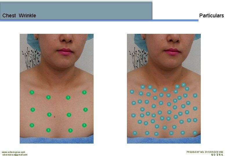 Chest Wrinkle www. reborncorea. com reborncorea@gmail. com Particulars PRESIDENT MD. BYUNGSUN KIM 원장 김병선