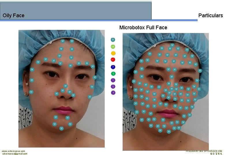 Oily Face Particulars Microbotox Full Face www. reborncorea. com reborncorea@gmail. com PRESIDENT MD. BYUNGSUN