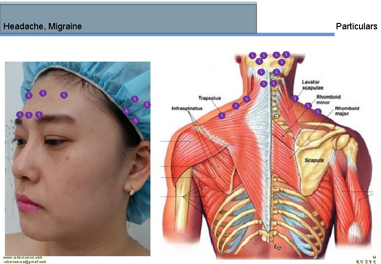 Headache, Migraine www. reborncorea. com reborncorea@gmail. com Particulars PRESIDENT MD. BYUNGSUN KIM 원장 김병선