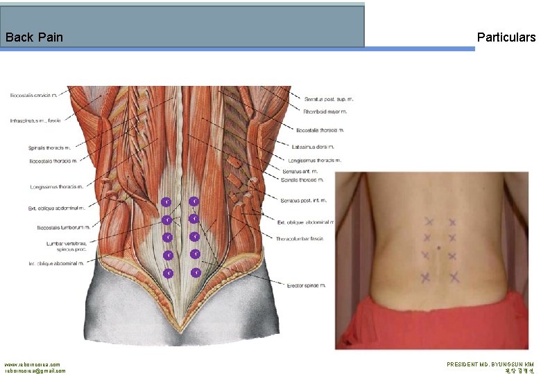 Back Pain www. reborncorea. com reborncorea@gmail. com Particulars PRESIDENT MD. BYUNGSUN KIM 원장 김병선
