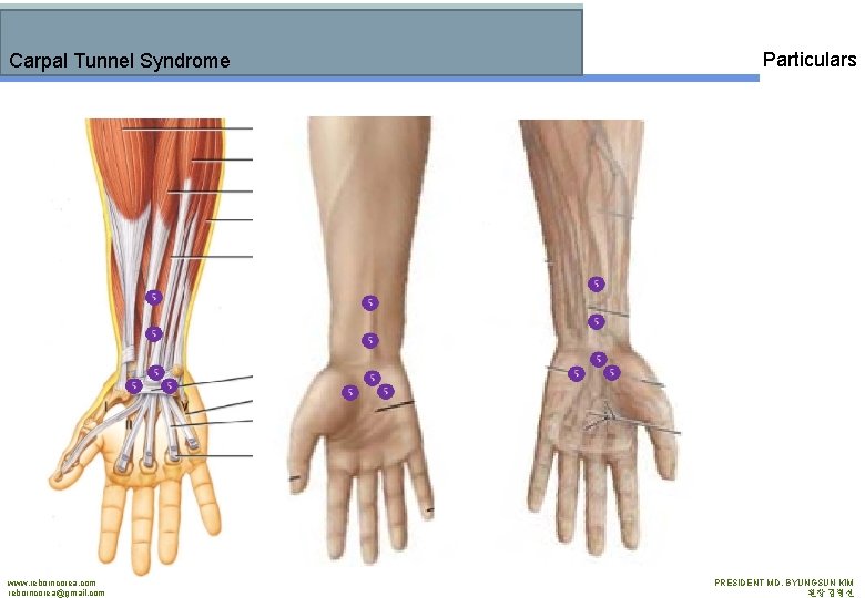 Carpal Tunnel Syndrome www. reborncorea. com reborncorea@gmail. com Particulars PRESIDENT MD. BYUNGSUN KIM 원장