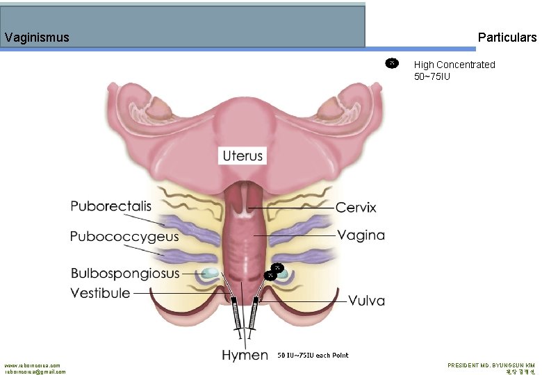 Vaginismus Particulars High Concentrated 50~75 IU www. reborncorea. com reborncorea@gmail. com PRESIDENT MD. BYUNGSUN