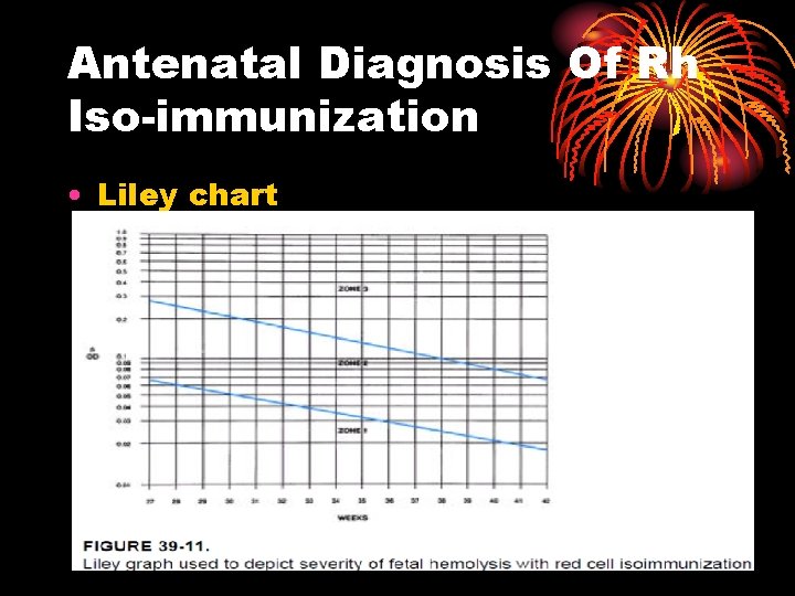 Antenatal Diagnosis Of Rh Iso-immunization • Liley chart 