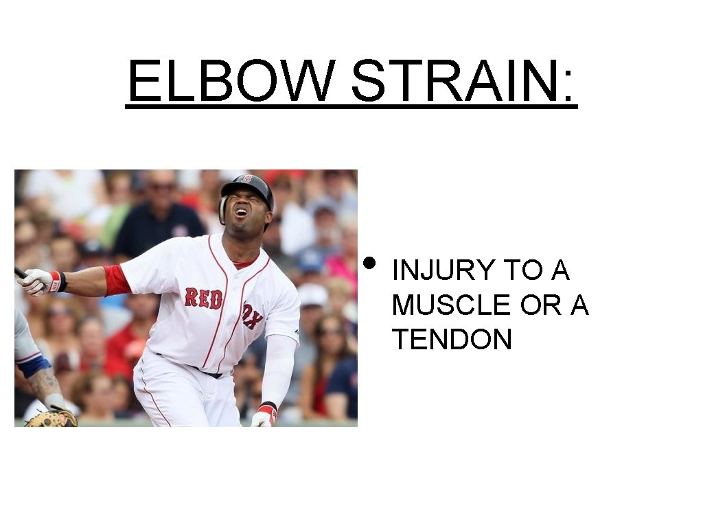 ELBOW STRAIN: • INJURY TO A MUSCLE OR A TENDON 