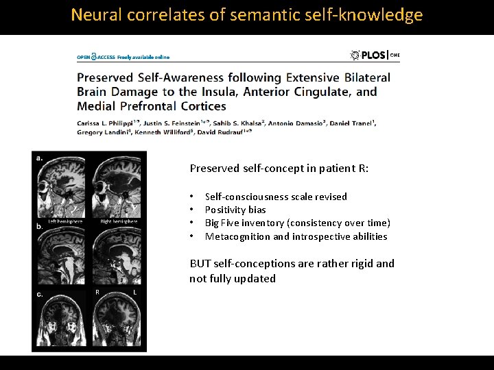 Neural correlates of semantic self‐knowledge Preserved self‐concept in patient R: • • Self‐consciousness scale