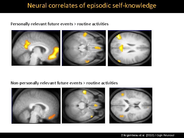 Neural correlates of episodic self‐knowledge Personally‐relevant future events > routine activities Non‐personally‐relevant future events