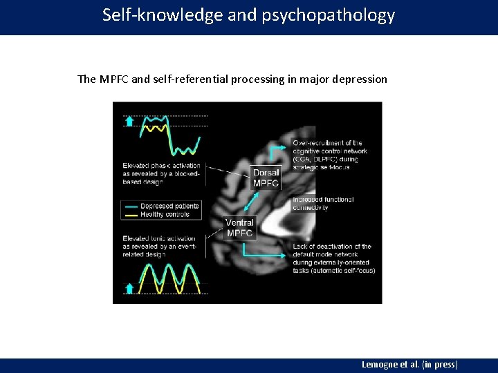 Self‐knowledge and psychopathology The MPFC and self‐referential processing in major depression Lemogne et al.