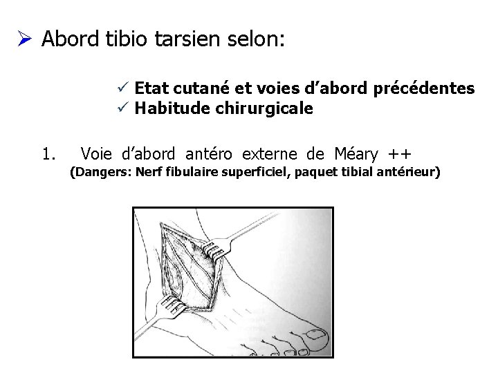 Ø Abord tibio tarsien selon: ü Etat cutané et voies d’abord précédentes ü Habitude