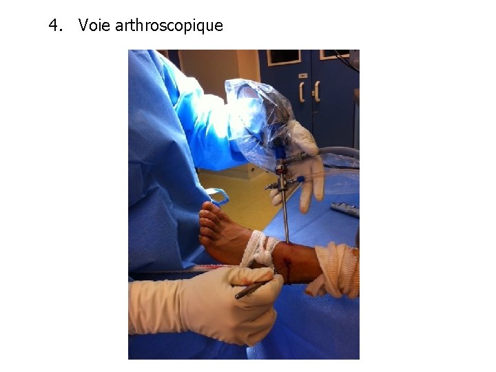 4. Voie arthroscopique 