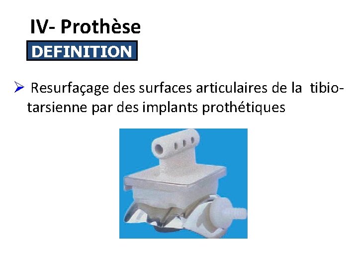 IV- Prothèse DEFINITION Ø Resurfaçage des surfaces articulaires de la tibiotarsienne par des implants