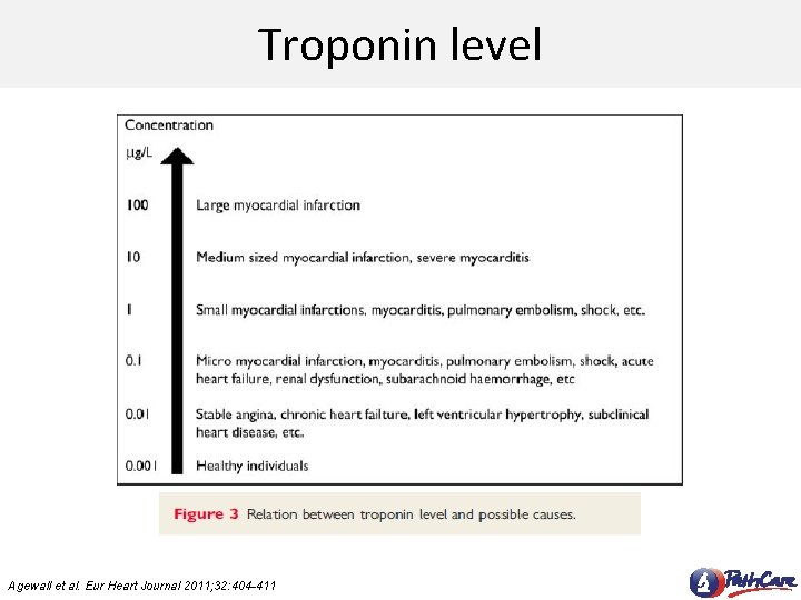 Troponin level Agewall et al. Eur Heart Journal 2011; 32: 404 -411 