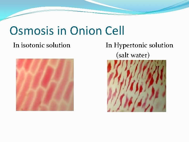 Osmosis in Onion Cell In isotonic solution In Hypertonic solution (salt water) 