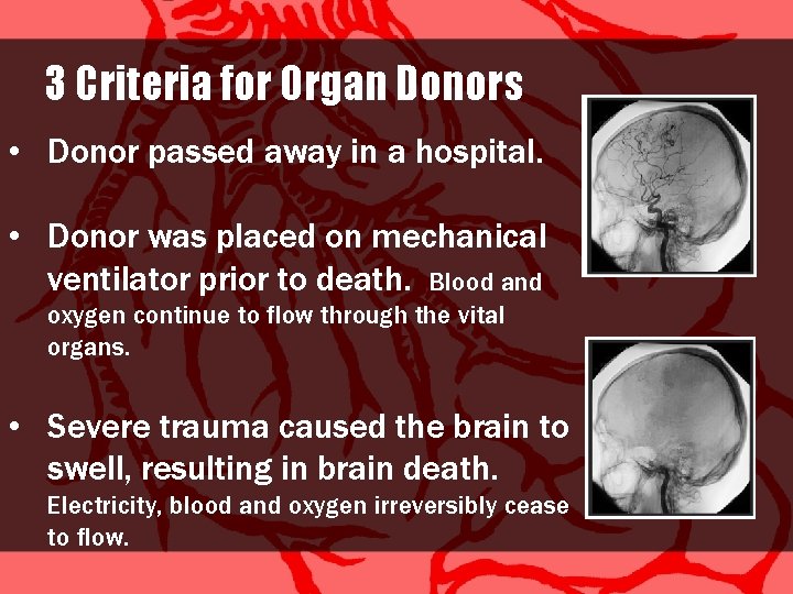 3 Criteria for Organ Donors • Donor passed away in a hospital. • Donor