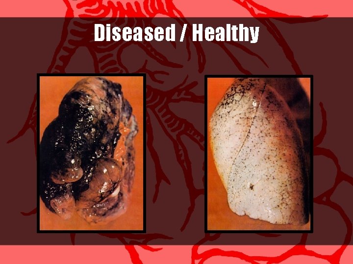 Diseased / Healthy 