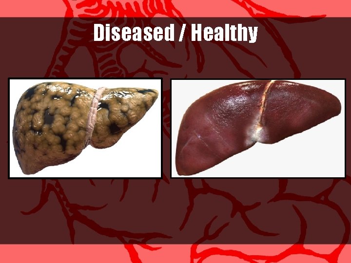 Diseased / Healthy 