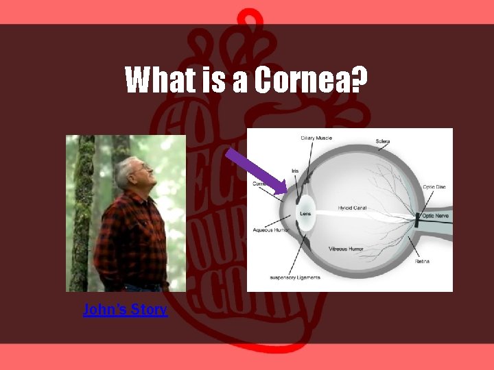 What is a Cornea? John’s Story 