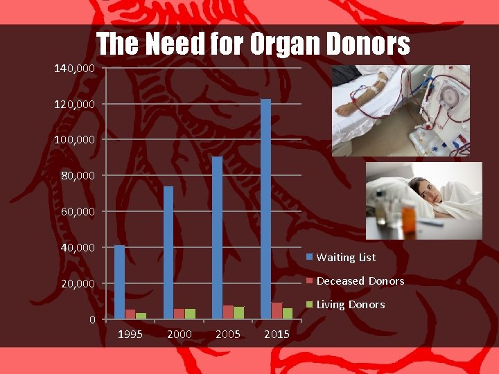 140, 000 The Need for Organ Donors 120, 000 100, 000 80, 000 60,