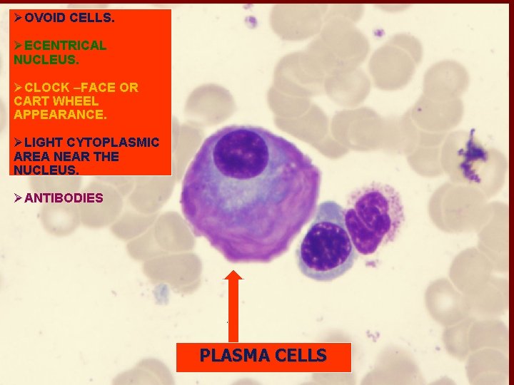 ØOVOID CELLS. ØECENTRICAL NUCLEUS. ØCLOCK –FACE OR CART WHEEL APPEARANCE. ØLIGHT CYTOPLASMIC AREA NEAR