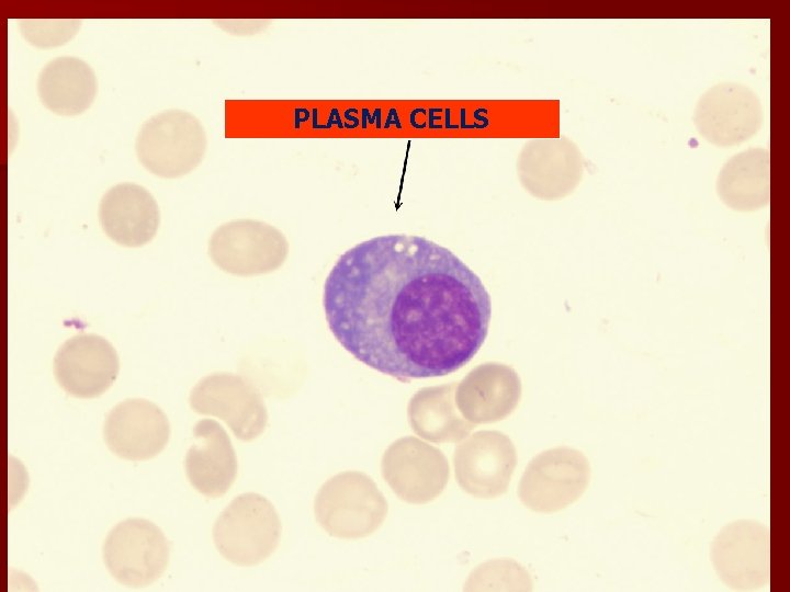 PLASMA CELLS PLASMA CELLS