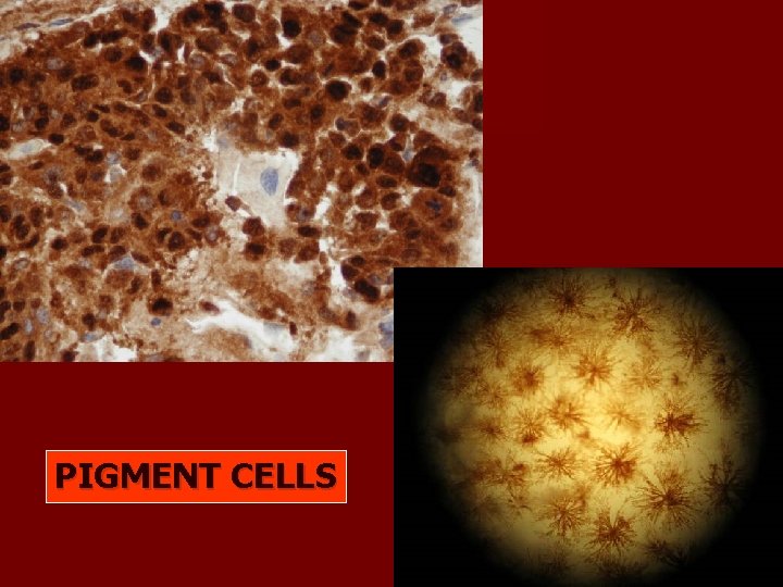 PIGMENT CELLS PIGMENT CELLS