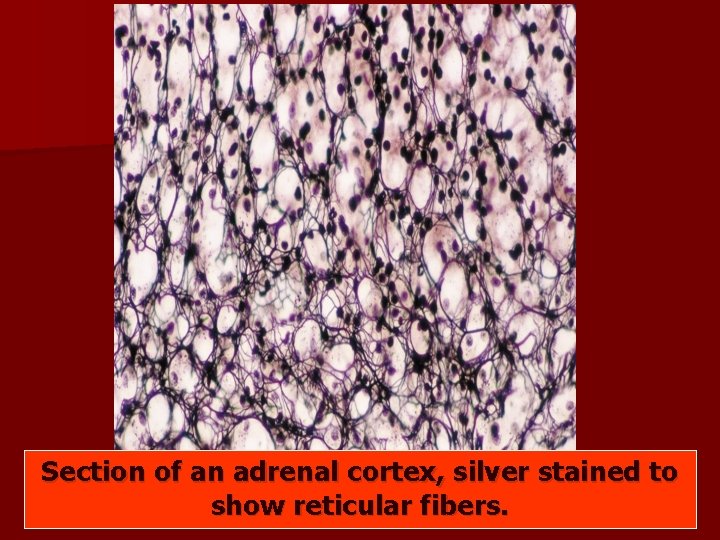 Section of an adrenal cortex, silver stained to show reticular fibers. Section of an adrenal cortex, silver stained to show reticular fibers.