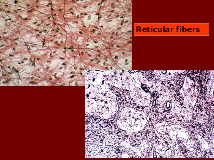 Reticular fibers Reticular fibers
