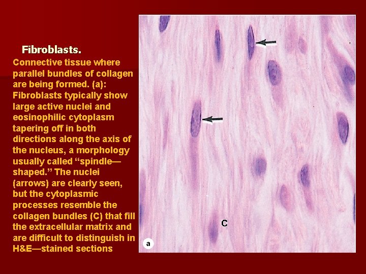 Fibroblasts. Connective tissue where parallel bundles of collagen are being formed. (a): Fibroblasts typically