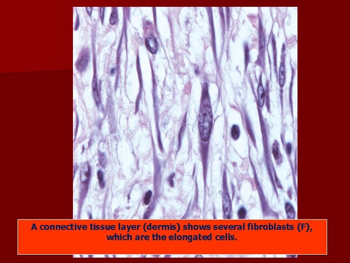 A connective tissue layer (dermis) shows several fibroblasts (F), which are the elongated cells. A connective tissue layer (dermis) shows several fibroblasts (F), which are the elongated cells.