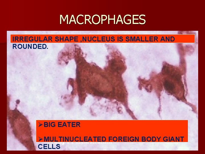 MACROPHAGES IRREGULAR SHAPE , NUCLEUS IS SMALLER AND ROUNDED. ØBIG EATER ØMULTINUCLEATED FOREIGN BODY