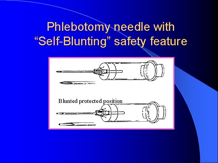 Phlebotomy needle with “Self-Blunting” safety feature Blunted protected position 