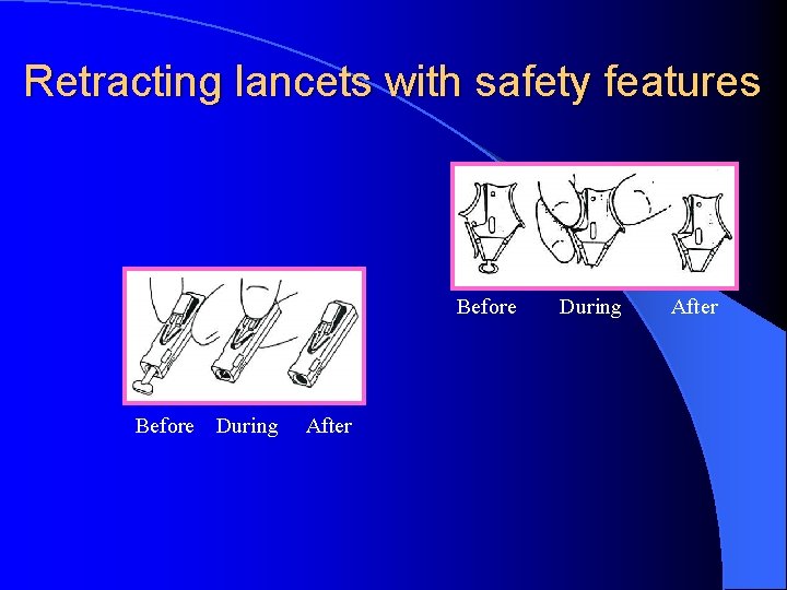 Retracting lancets with safety features Before During After 