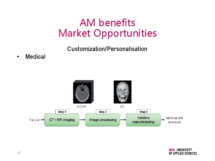 AM benefits Market Opportunities Customization/Personalisation • Medical 17 