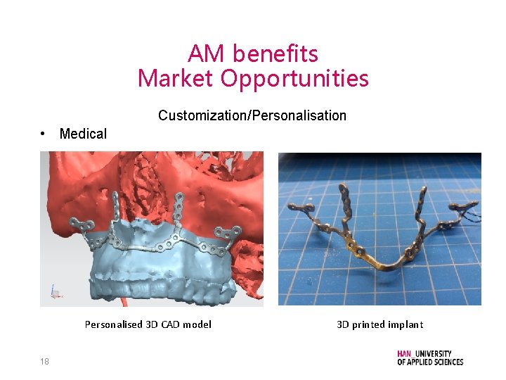 AM benefits Market Opportunities Customization/Personalisation • Medical Personalised 3 D CAD model 18 3