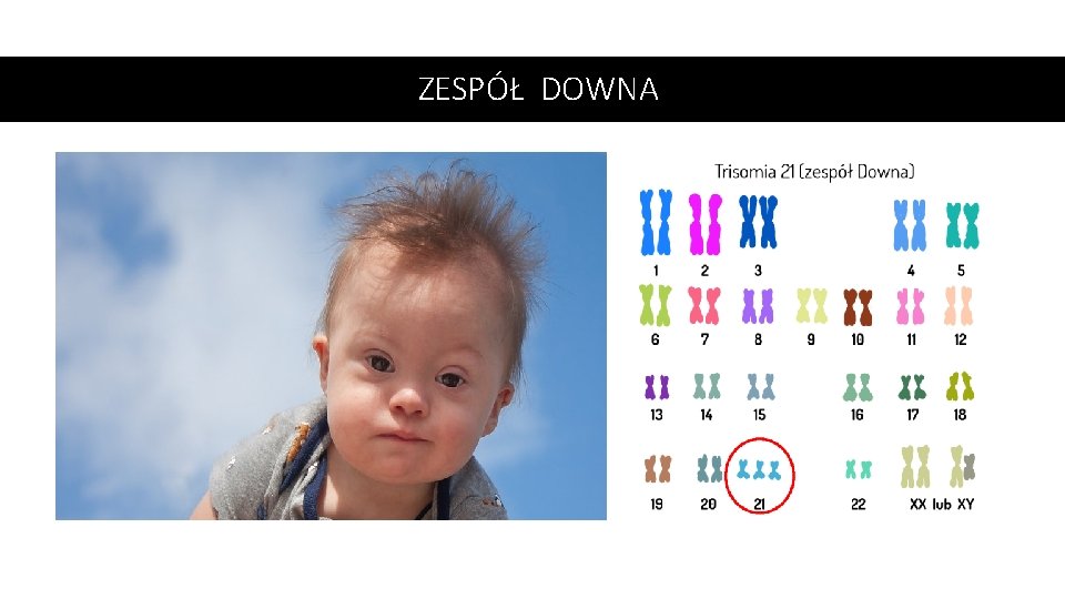 ZESPÓŁ DOWNA 