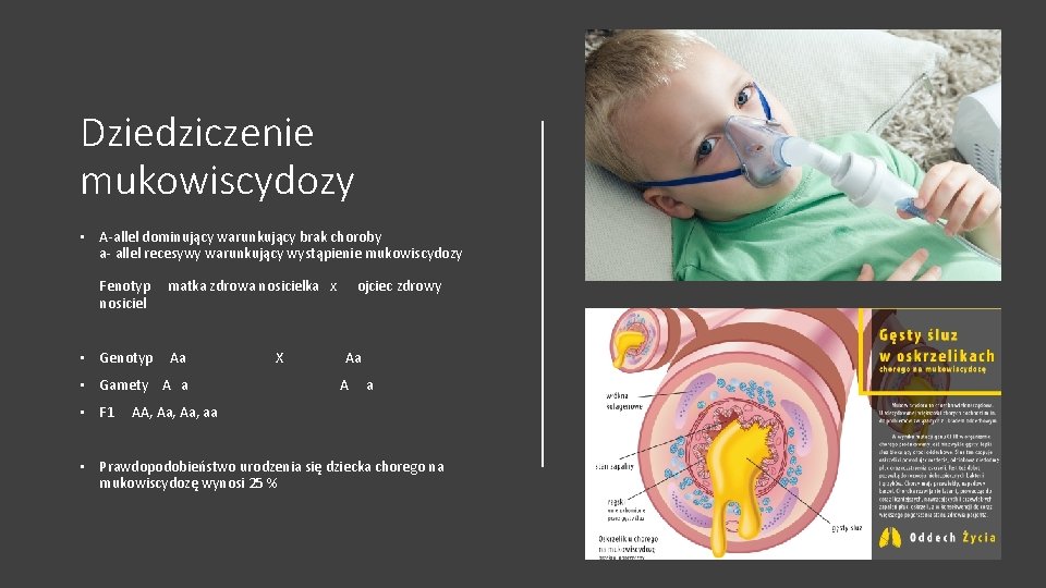 Dziedziczenie mukowiscydozy • A-allel dominujący warunkujący brak choroby a- allel recesywy warunkujący wystąpienie mukowiscydozy